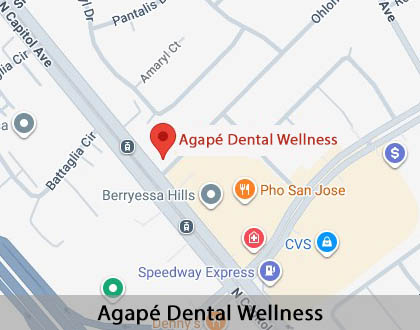 Map image for Dental Implants in San Jose, CA
