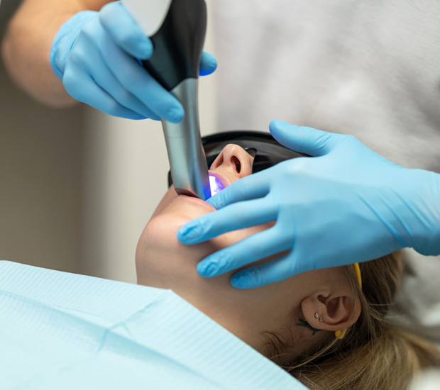 San Jose Intraoral Photos